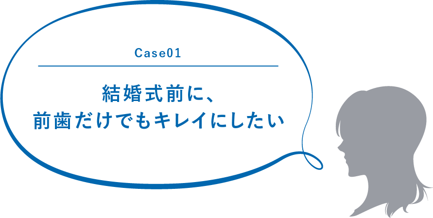 Case01 結婚式前に、前歯だけでもキレイにしたい