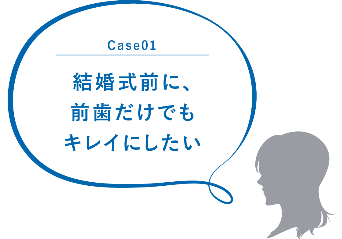 Case01 結婚式前に、前歯だけでもキレイにしたい